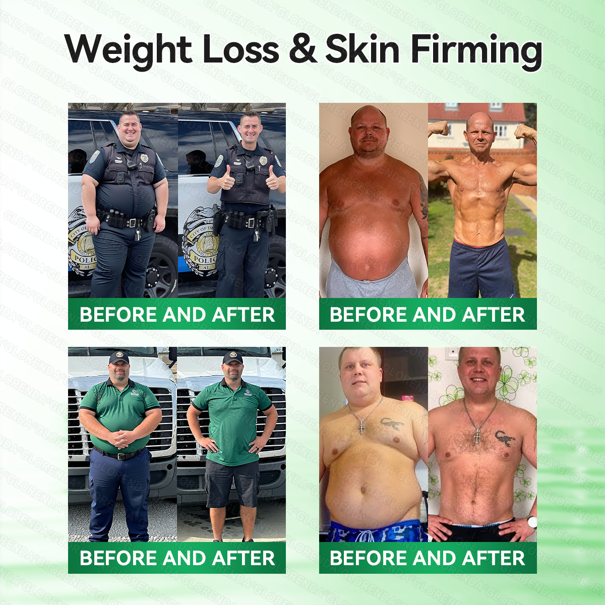 𝐎𝐟𝐟𝐢𝐜𝐢𝐚𝐥 𝐒𝐭𝐨𝐫𝐞 | 🎯🎯 𝐆𝐋𝐎𝑹𝑬𝗡𝗗𝗔® 𝑴𝒐𝒓𝒊𝒏𝙜𝙖 · 𝘽𝙚𝙧𝙗𝙚𝙧𝒊𝒏𝒆 × 𝐍𝐴𝑫+ 10-𝐢𝐧-1 𝑨𝒅𝒗𝒂𝒏𝒄𝐞𝐝 𝑵𝒂𝙣𝙤 𝑴𝒊𝒄𝒓𝒐𝒏𝒆𝒆𝗱𝗹𝗲 𝐏𝐚𝒕𝗰𝗵 (𝐉𝐮𝐬𝐭 𝐨𝐧𝐜𝐞 𝐚 𝐝𝐚𝐲, 𝐯𝐢𝐬𝐢𝐛𝐥𝐞 𝐜𝐡𝐚𝐧𝐠𝐞𝐬 𝐢𝐧 𝟕 𝐝𝐚𝐲𝐬) ✅ 𝐅𝐨𝐫 𝐨𝐛𝐞𝒔𝒊𝒕𝒚, 𝐥𝐨𝐨𝐬𝐞 𝐬𝐤𝐢𝐧, 𝐝𝐢𝐚𝐛𝒆𝒕𝒆𝒔, 𝐬𝐥𝐞𝐞𝐩 𝐚𝐩𝐧𝐞𝐚, 𝐣𝐨𝐢𝐧𝐭 𝐢𝐬𝐬𝐮𝐞𝐬, 𝐚𝐧𝐝 𝐦𝐨𝐫𝐞